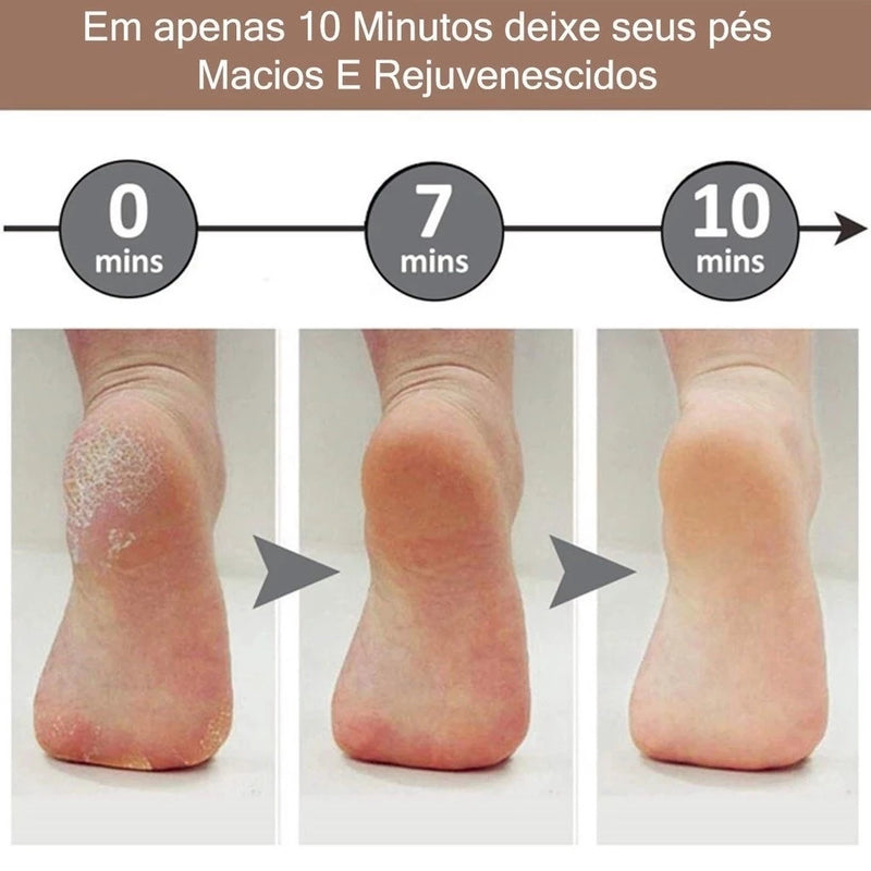 Esfoliador Elétrico para Pés — Lixador Premium que Remove Calos Instantaneamente